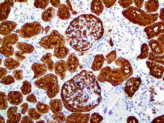 IHC of CD10 on an FFPE Kidney Tissue